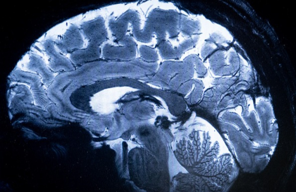 Scientists find link between thumb length and brain size