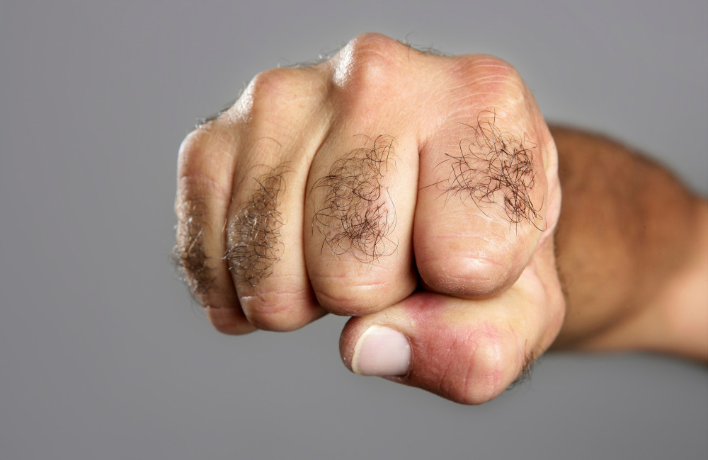 Tatsebuds in hair follicles may lead to new treatments for unwanted hair