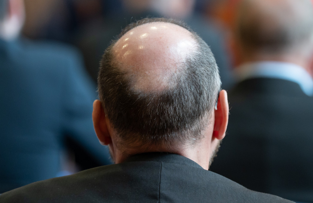 Scientists grow lab-grown hair